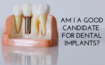 Am I A Good Candidate For Dental Implants?