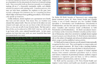 Teeth in One Day Article by Dr. Bobby Birdi