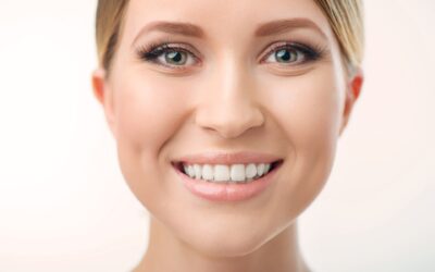 How to Protect Your Smile from White Spots