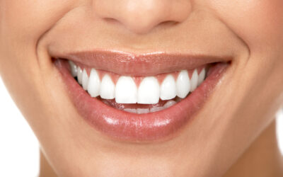 Dental Implants for a Natural Smile: Are They Right For You?